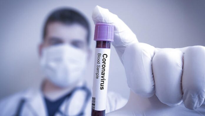 Ce organ important al corpului mai este afectat de coronavirus